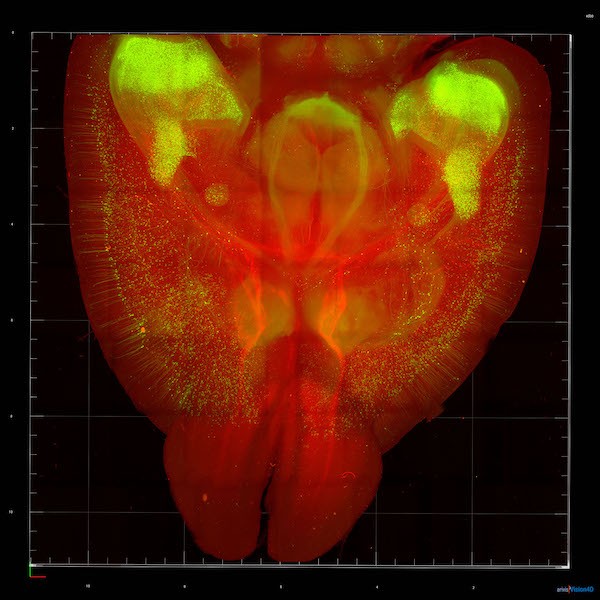 clearingwhole mouse Lightsheet